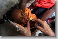 Dr. Bill Harden checks on Jean Chilove, 15 months, during a medical clinic by volunteers with the North Carolina Baptist Men Disaster Relief team in Cabaret, Haiti Friday May 7, 2010.  ETHAN HYMAN  - ehyman@newsobserver.com